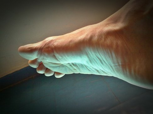 Ankle pain